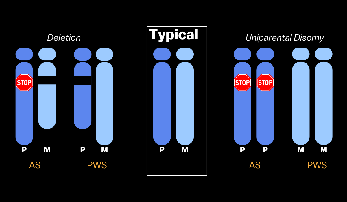 Graphic displaying what deletion and UPD look like for Angelman syndrome vs. Prader-Willi syndrome